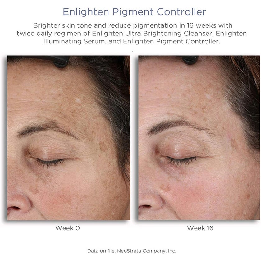 Neostrata Enlighten Pigment Controller Fluid For Dark spots and Uneven skin tone 50ml