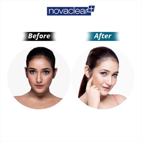Novaclear Whitening Facial Brightening Day Cream with SPF50+, 50ml
