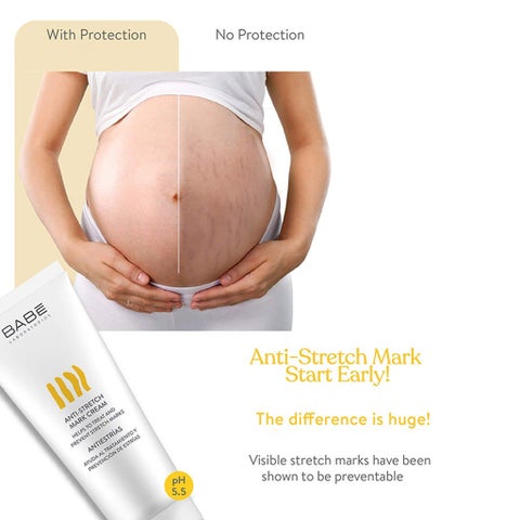 Babe Anti-Stretch Marks Cream 200ml