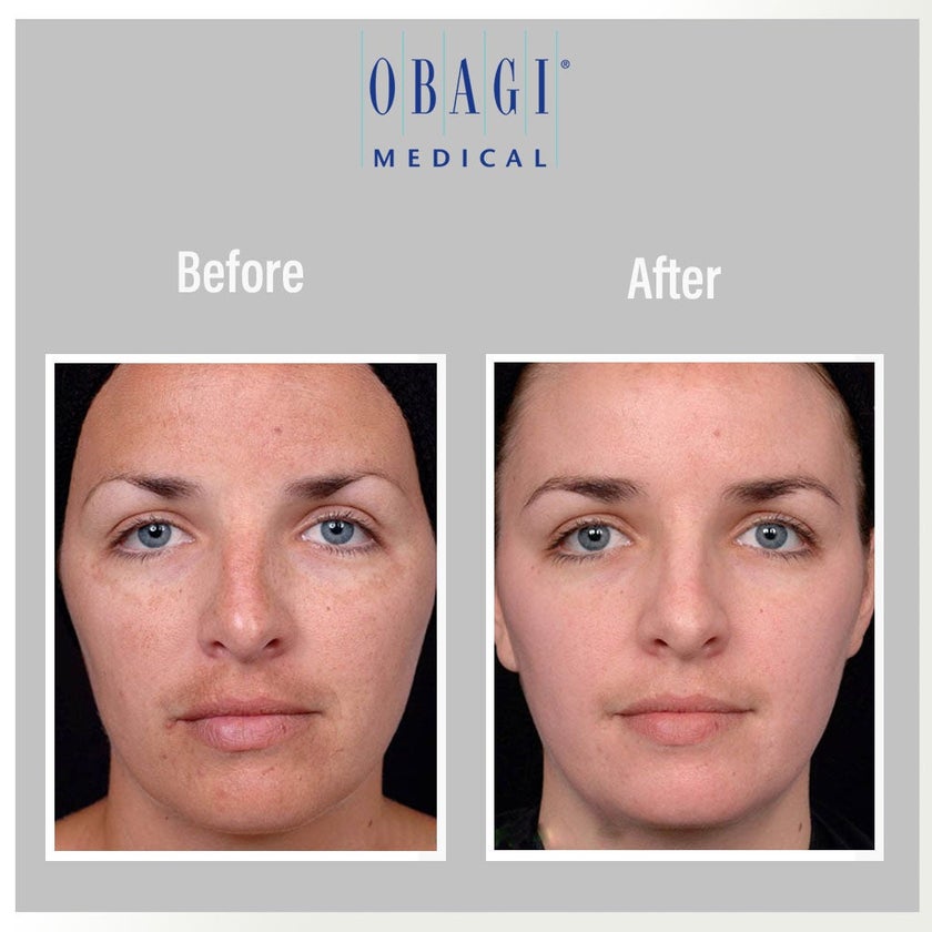 Obagi - C Fx C -Clarifying Skin Brightening Facial Serum With Vitamin C 30ml