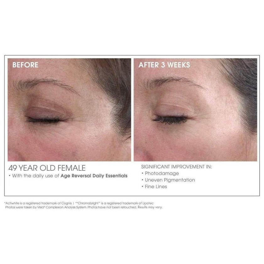 GlowBiotics Probiotics Advanced Retinol Renewal Anti-Aging Treatment For Face And Neck 30ml