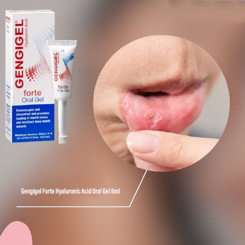 Gengigel Forte Hyaluronic Acid Oral Gel, Pain Relieving Oral Gel For Mouth Ulcers & Mouth Wounds 8ml