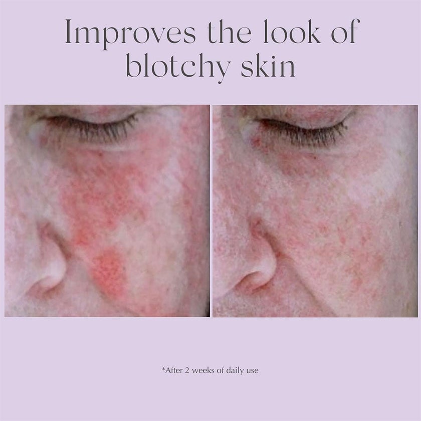 Exuviance AntiRedness Calming Face Serum 29g