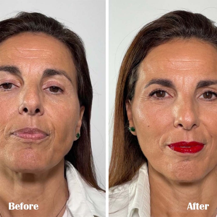 LaCabine 24K Gold Flash 2ml Golden Facial Serum Ampoules For Instant Glowing Skin, Limited Edition