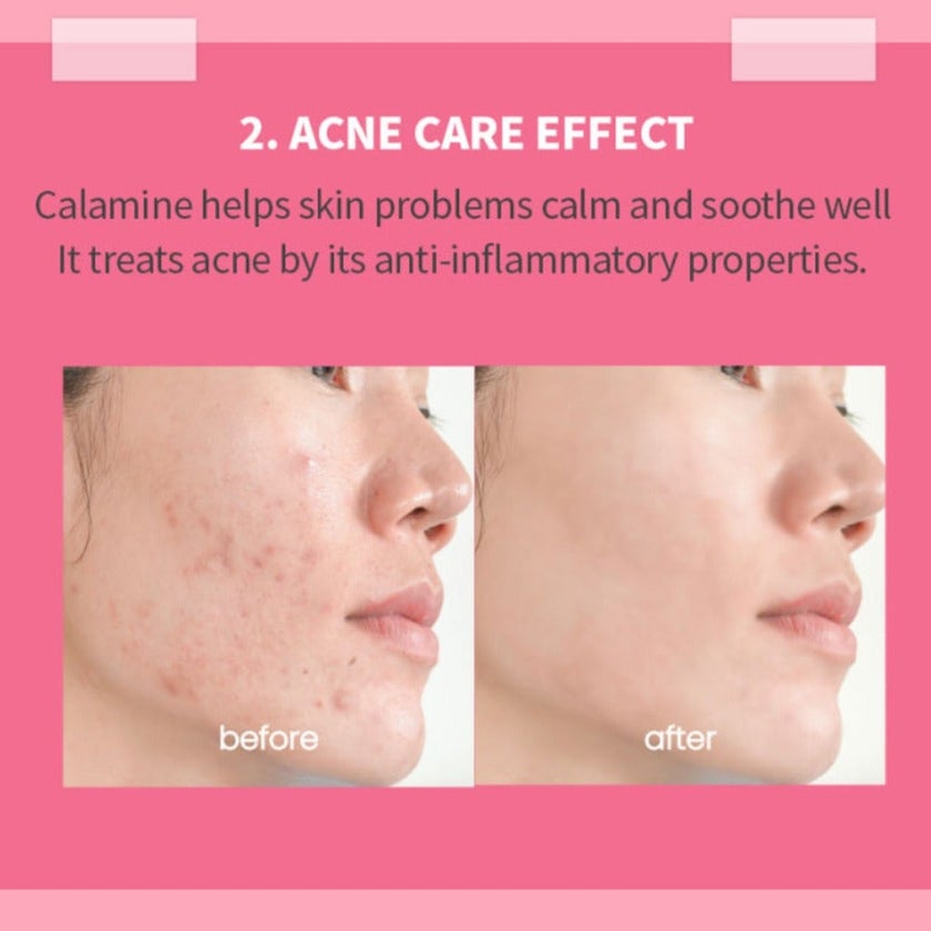 K-Secret Calamine 30 Days Secret Toner For Sensitive Skin 160ml