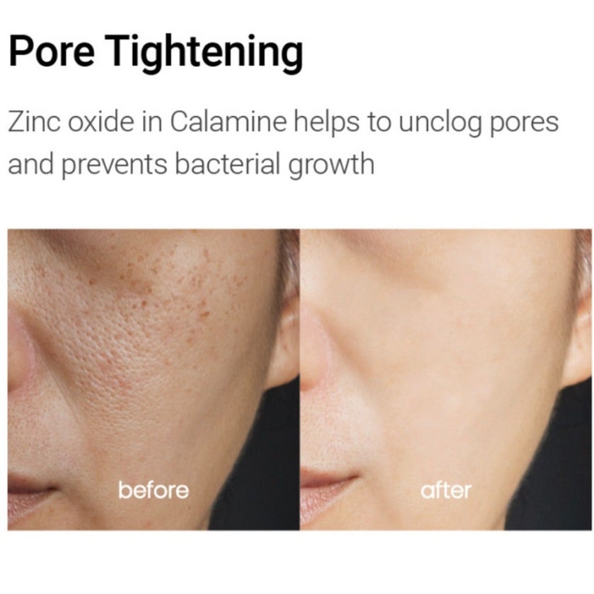 K-Secret Calamine Derma Secret Pink Solution Serum For Oily & Combination Skin Types 50ml