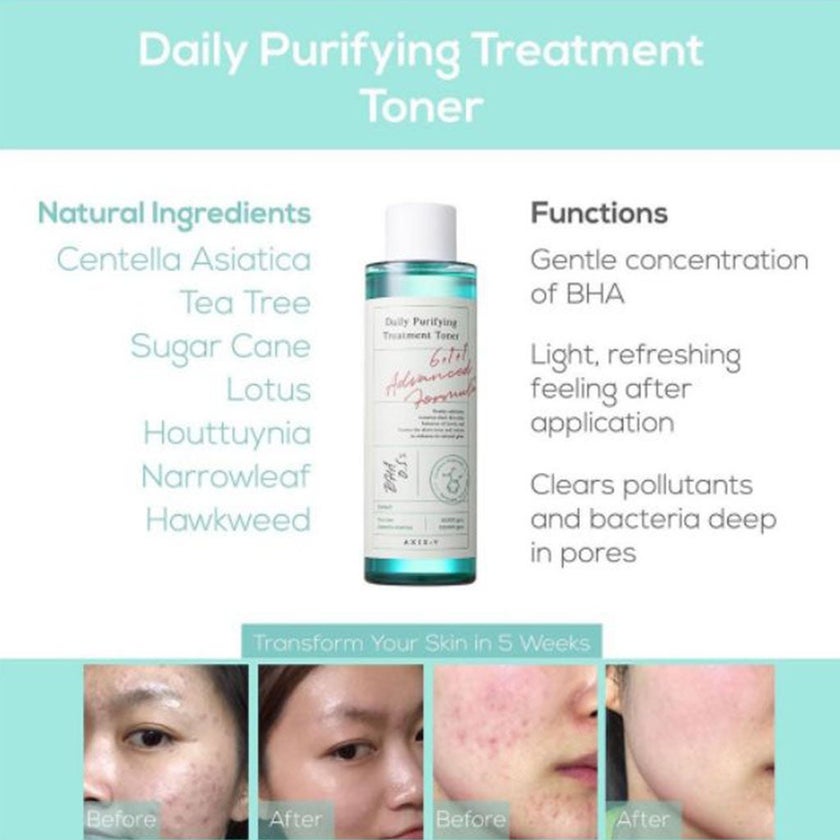 Axis-Y Daily Purifying Treatment Exfoliate + Soothe Facial Toner 200ml