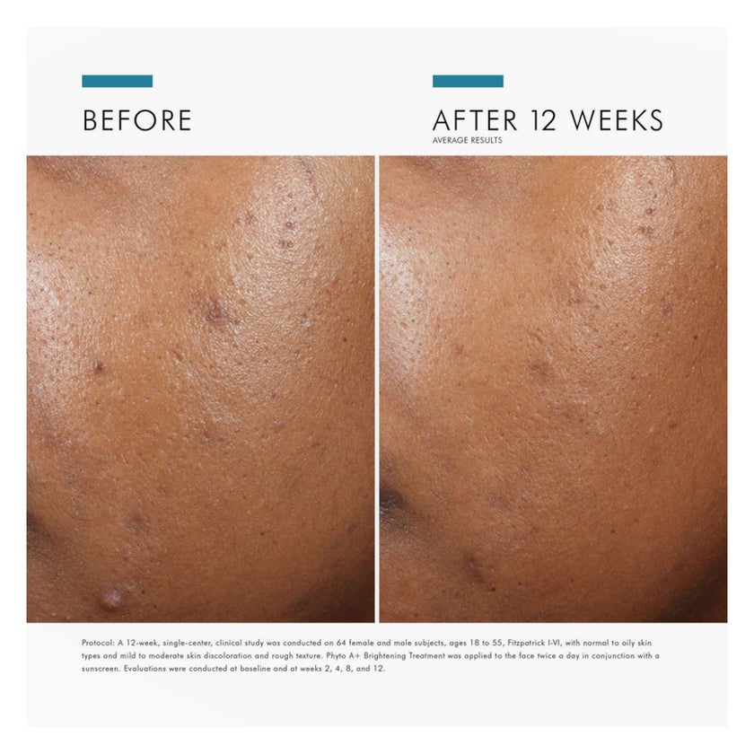 SkinCeuticals Phyto A+ Brightening Treatment Moisturiser - 30ml