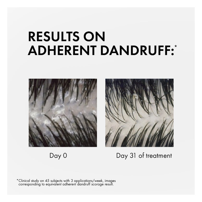 فيتشي ديركوس شامبو مضاد للقشرة مع السيلينيوم دي إس وحمض الساليسيليك لحكة فروة الرأس والشعر العادي إلى الدهني 390 مل