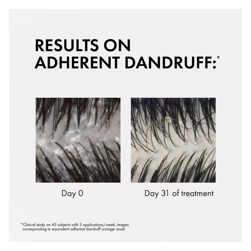 Vichy Dercos Anti-Dandruff DS Shampoo Acid For Dry Hair 390ml