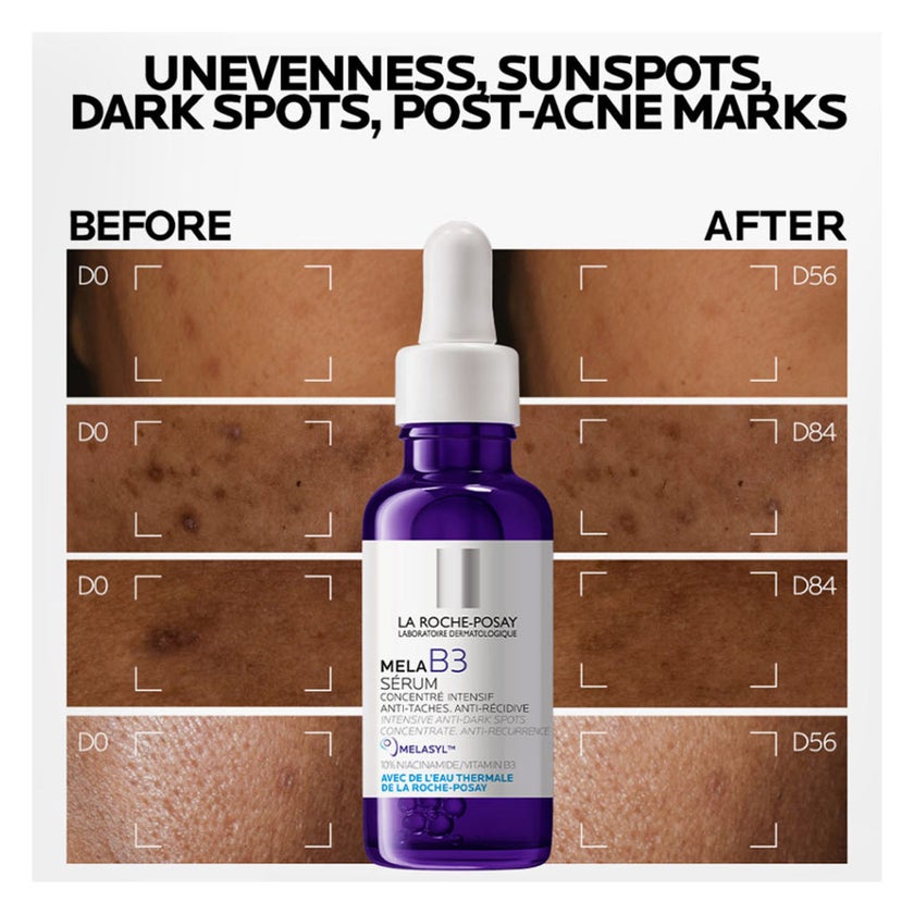 La Roche-Posay Mela B3 Niacinamide Anti-Dark Spots Serum, All Skin Types - 30ml