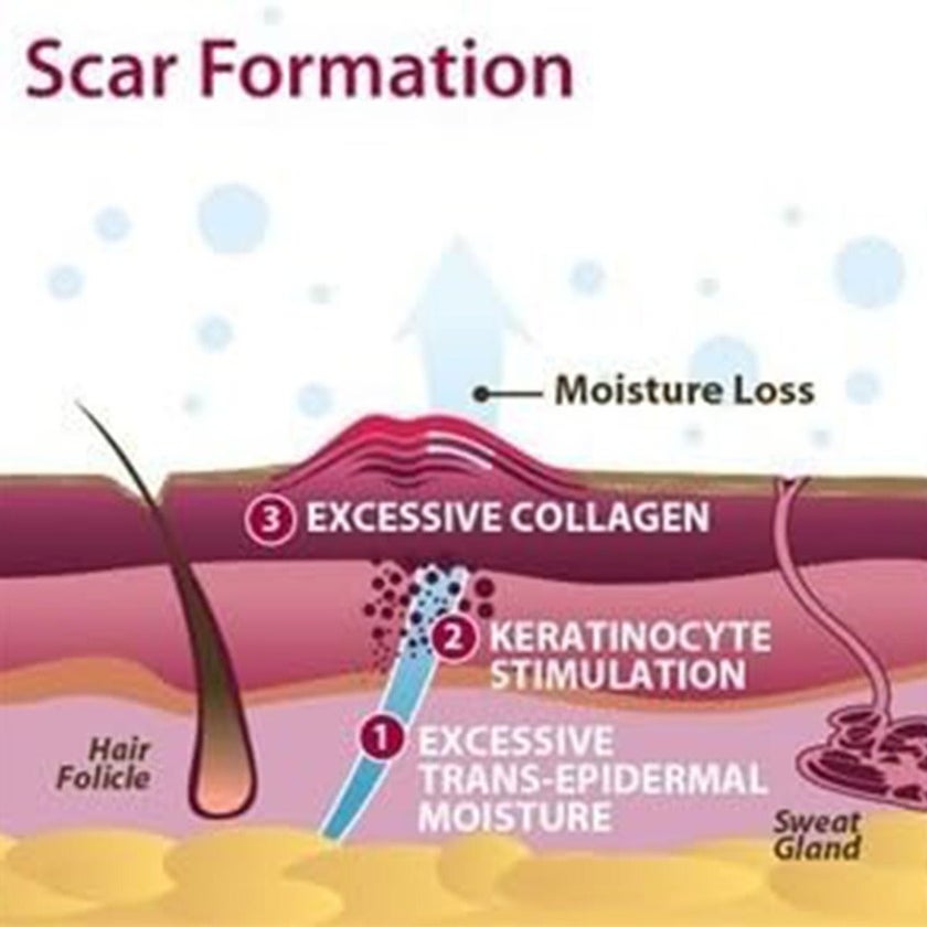 Biodermis Prosil SPF15 Silicone Stick For Scars 4.25g