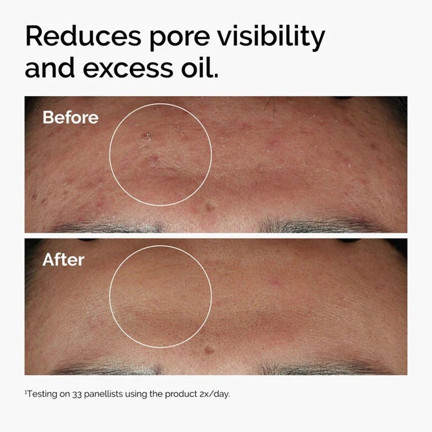 The Ordinary Niacinamide 10% + Zinc 1% Face Serum For Blemish-Prone Skin 120ml