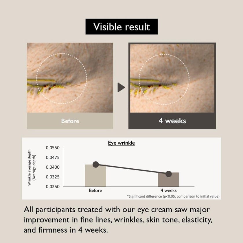 Haruharu Wonder Black Rice Bakuchiol Eye Cream For Dark Circles 20ml 