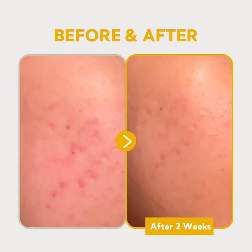 Tirtir Pure Vitamin C 24 Skin Brightening Serum For Dark Spots 30ml 