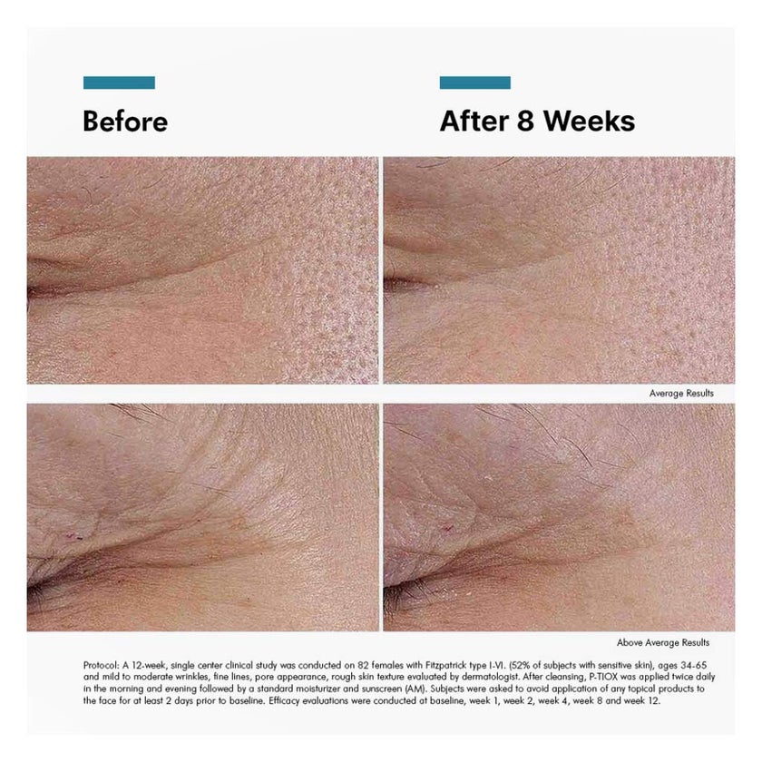 SkinCeuticals P-TIOX Anti-Wrinkle Peptide Serum - 30ml