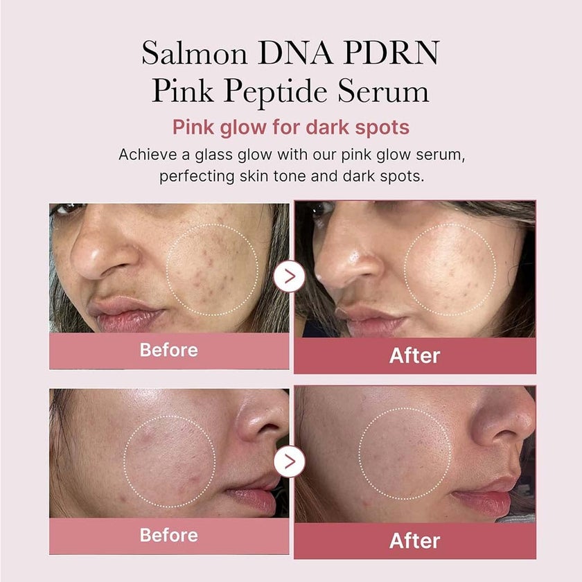 Medicube PDRN Pink Peptide Face Serum For Dark Spots 30ml