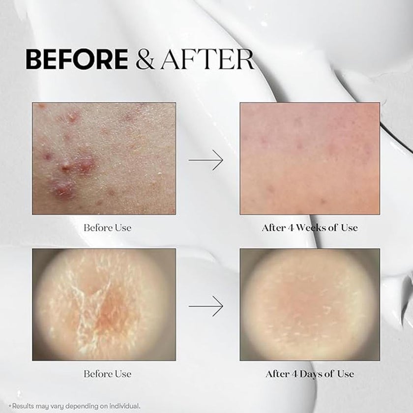 VT Cosmetics Cica Mild Hyalon Reedle 50 Shot All Day Starter Face Serum 50ml