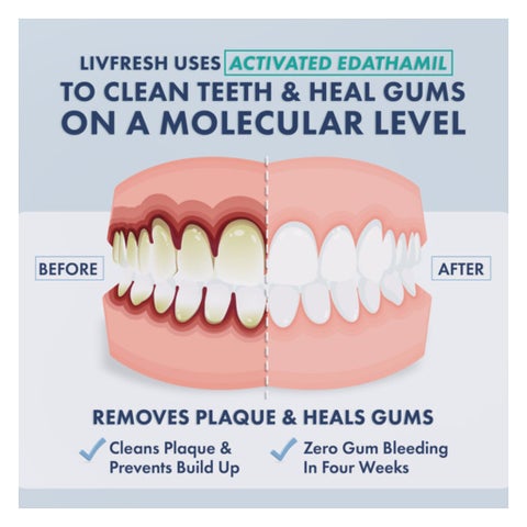 Livfresh Mild Peppermint Whitening Non-Foaming Gel Toothpaste 50g
