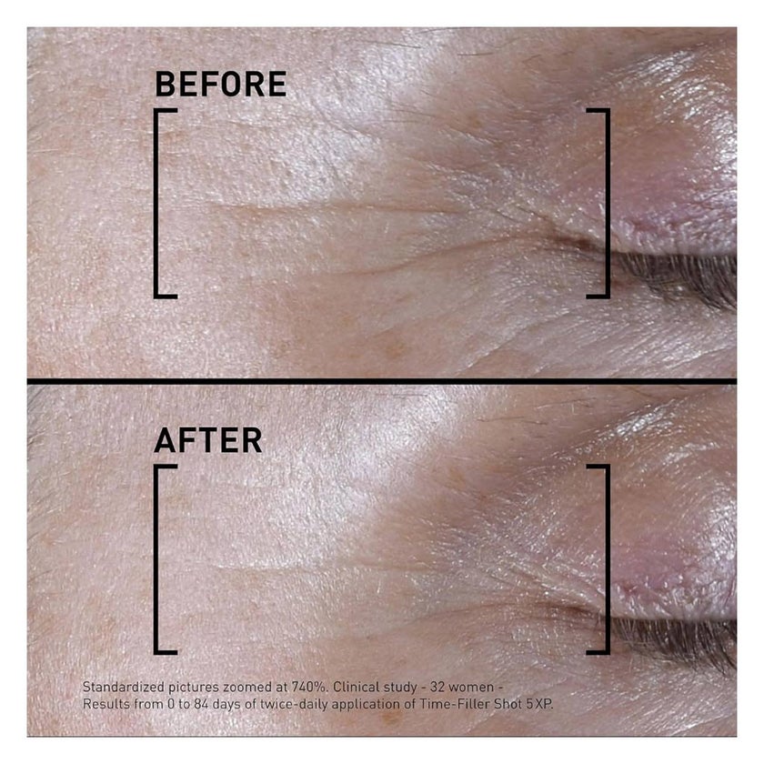 Filorga Time Filler Shot 5XP Anti-Wrinkle Concentrated Serum 15ml