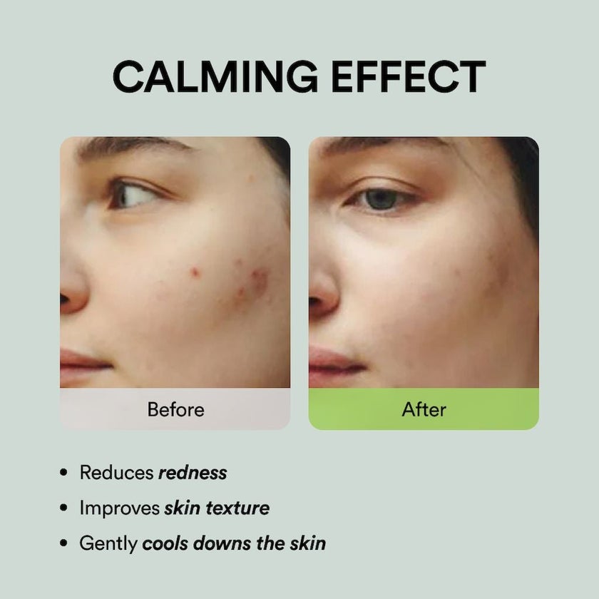 Abib Heartleaf Spot Pad Calming Touch, Pack of 80's