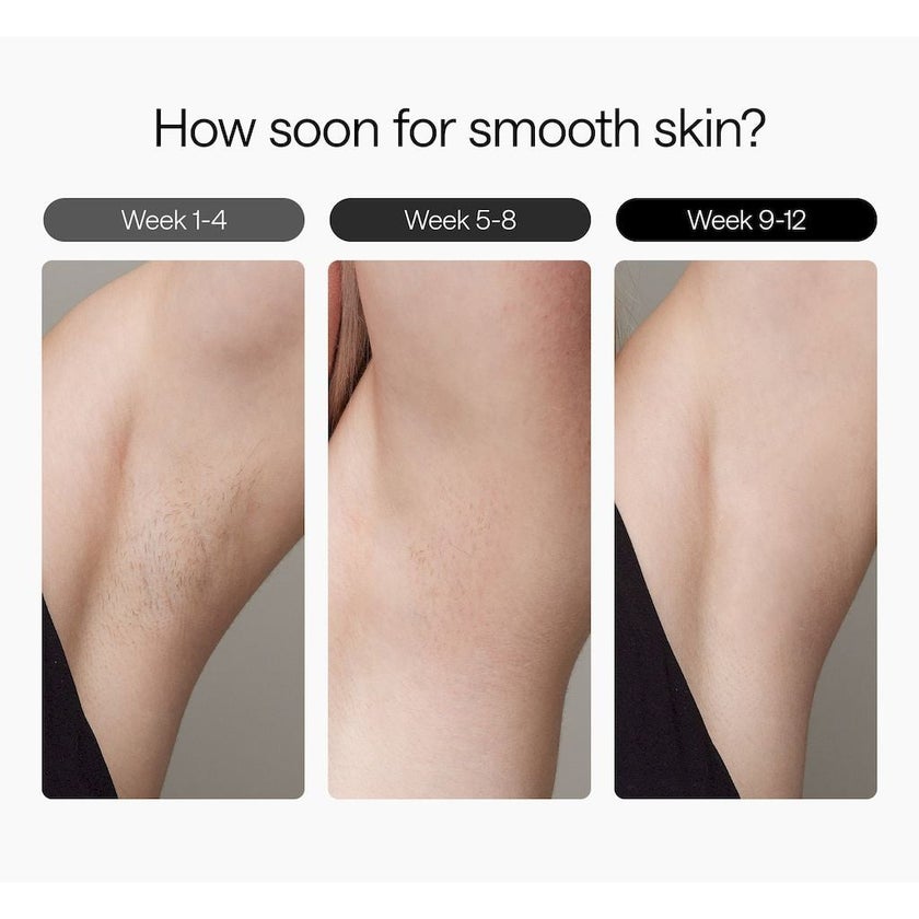 Ulike Air 3 IPL Hair Removal Device With Leather Case - Purple 