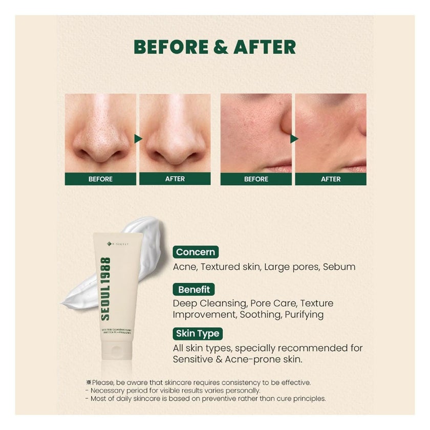 K-Secret Seoul 1988 Pine Cica 1% + Probiotics Cleansing Foam 150ml