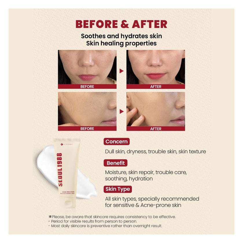 K-Secret Seoul 1988 Snail Mucin 93% + Rice Extract Cream 100ml