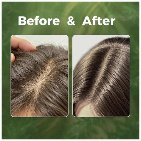 ByNature Rosemary Mint Scalp Serum 50ml
