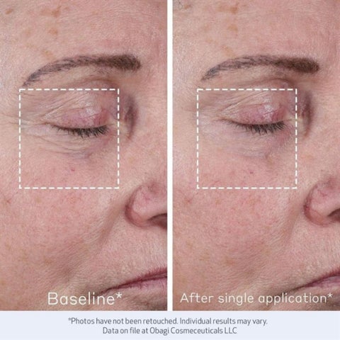 Obagi Elastiderm Advanced Filler Concentrate - 20ml