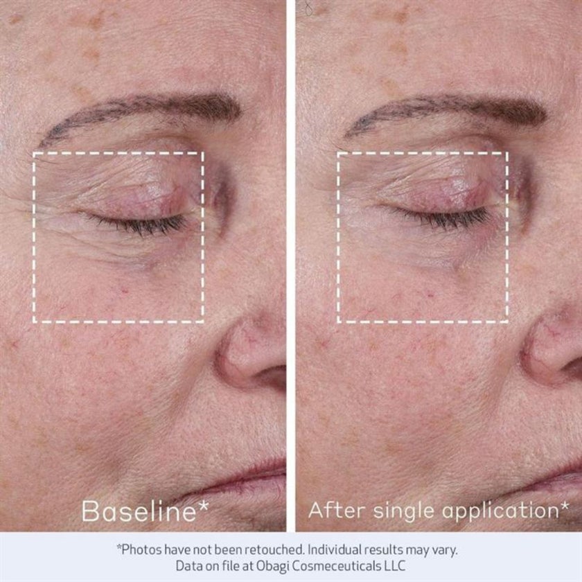 Obagi Elastiderm Advanced Filler Concentrate - 20ml