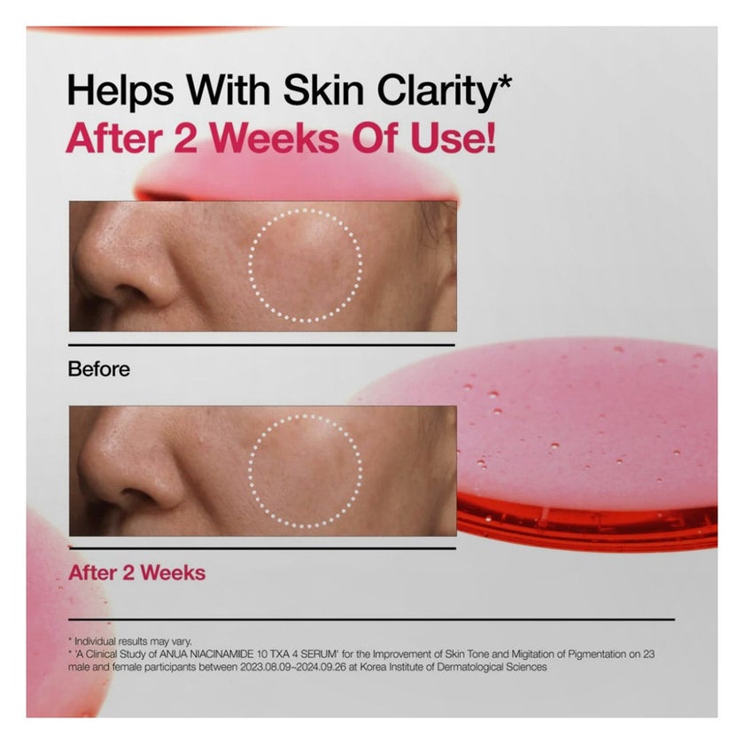 Anua Niacinamide 10 + TXA 4 Dark Sport Correcting Serum 30ml
