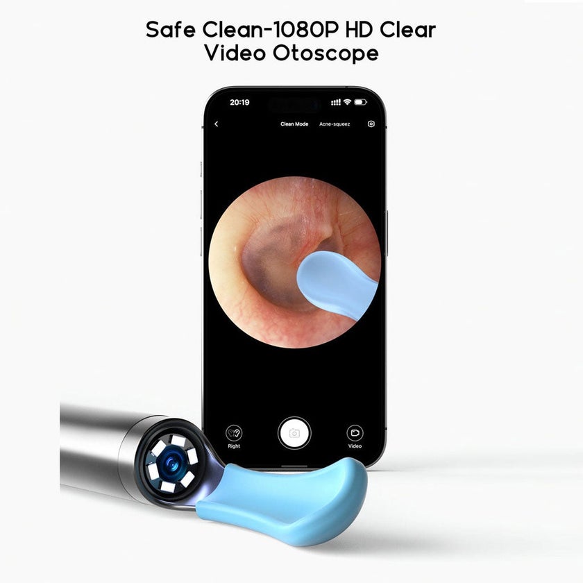 Bebird EarSight R1 Smart Earwax Removal Tool Kit