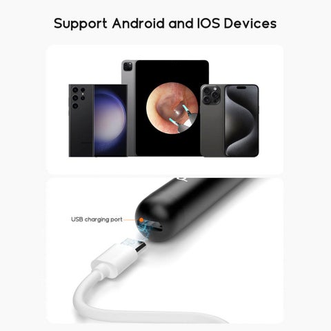 Bebird EarSight R1 Smart Earwax Removal Tool Kit