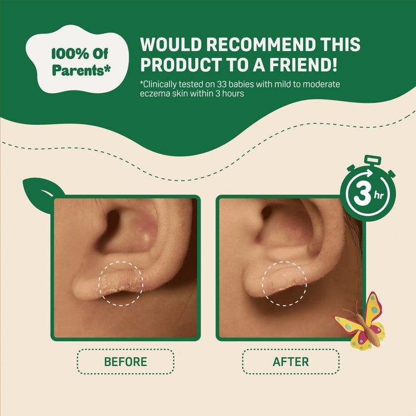 Pigeon Natural Botanical Baby Dermasoothe Cream 50ml