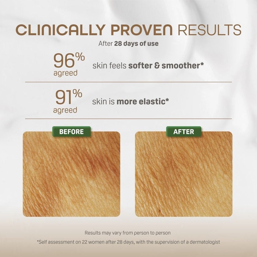 Pigeon Natural Botanical Maternity Stretch Mark Cream 150ml