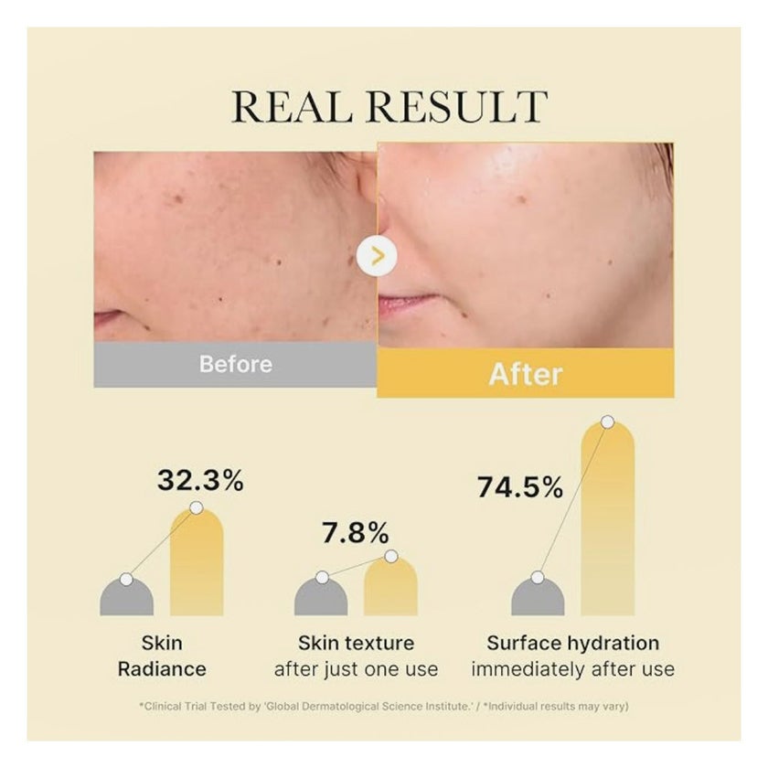 Medicube Kojic Acid Turmeric Brightening Gel Face Sheet Mask, Pack of 4's