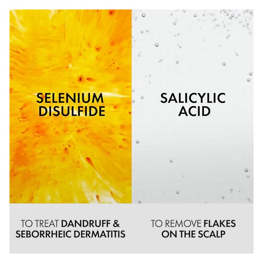 Vichy Dercos Anti-Dandruff Treatment Shampoo Dry Hair 390ml