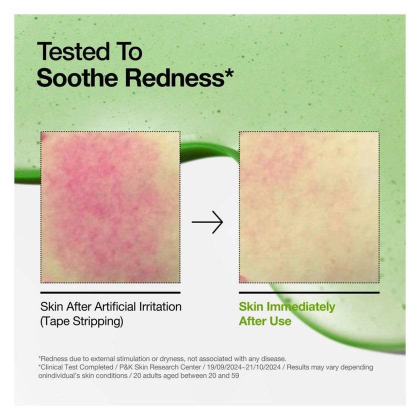 Anua Azelaic Acid 10 + Hyaluron Redness Soothing Serum 30ml