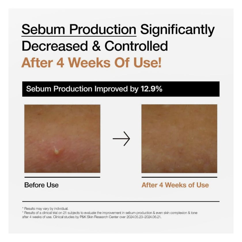 Anua Rice 70 + Ceramide Glow Milky Face Toner 250ml