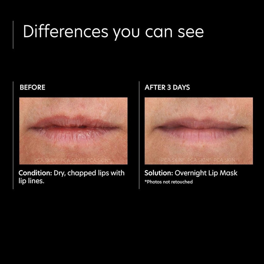 PCA Skin Overnight Lip Mask 13g