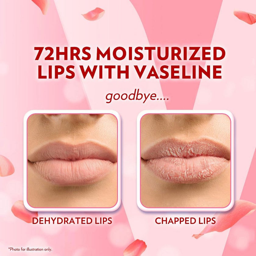 Vaseline Rose Lips Lip Therapy Balm 7g