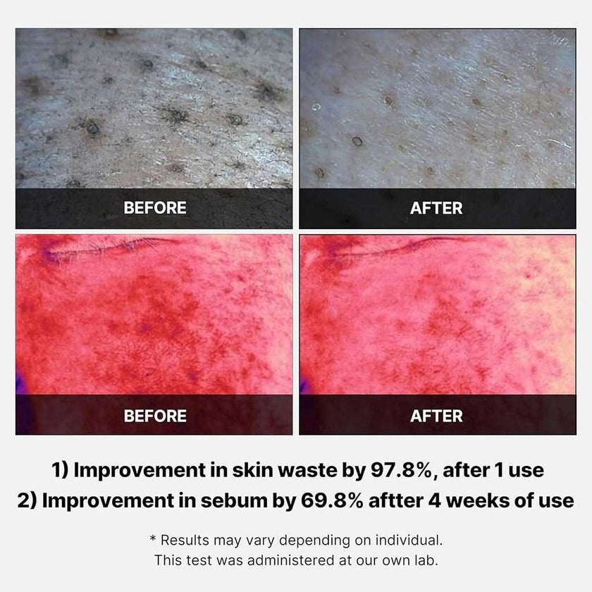 Medicube Red Succinic Acid Peeling Pads 155g, Pack of 70's