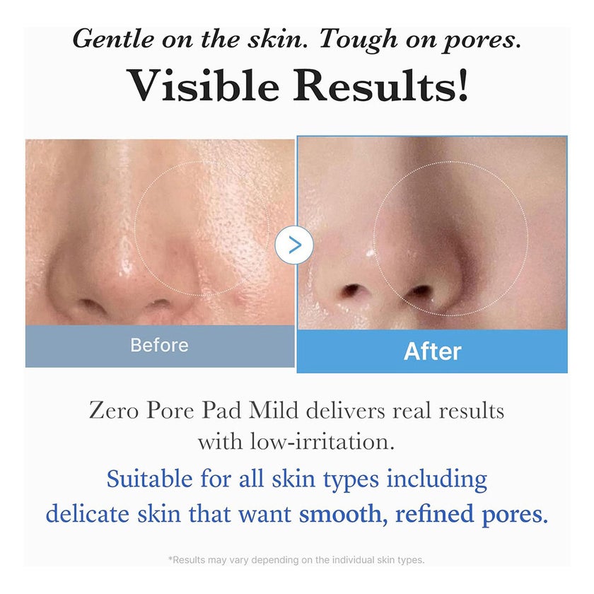 Medicube Zero Pore Pads Mild 155g, Pack of 70's