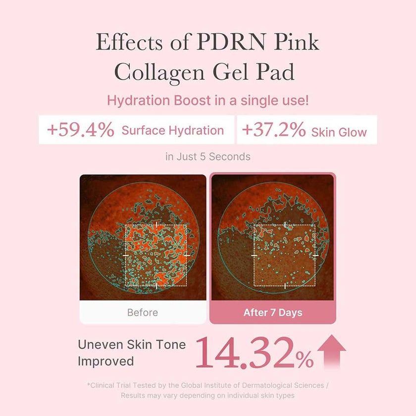 Medicube PDRN Pink Collagen Toning Gel Toner Pads 120ml, Pack of 70's