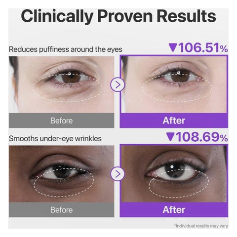 لصقات تحت العين بالكولاجين وNAD+ رقم 9 نومبوزين - 5 أزواج