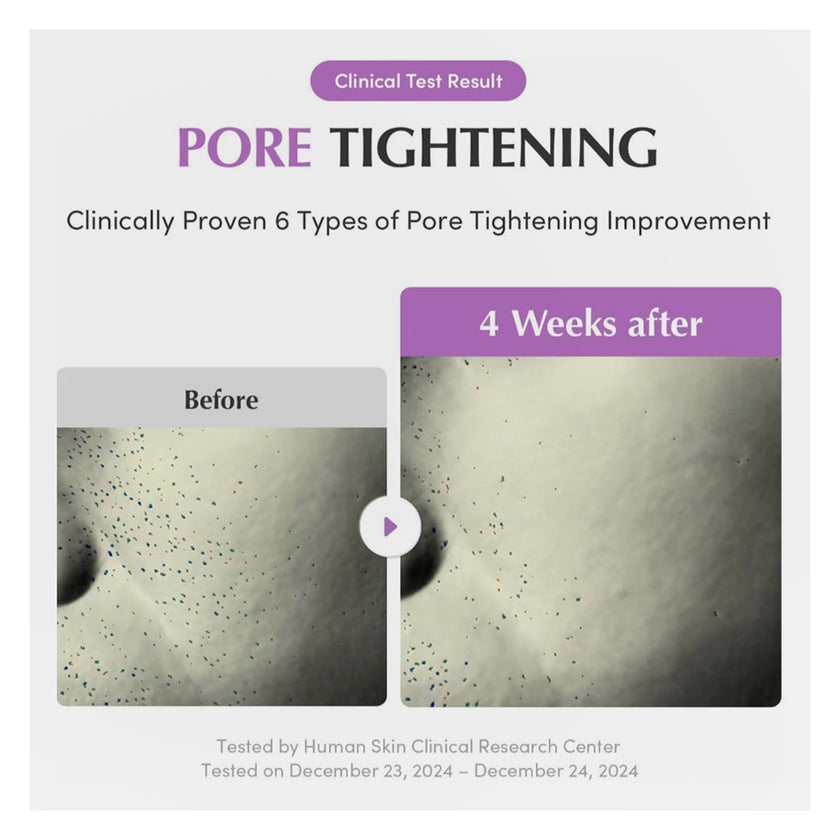 Eqqualberry Pore Fit Purple PDRN Pore Minimizing Serum 30ml