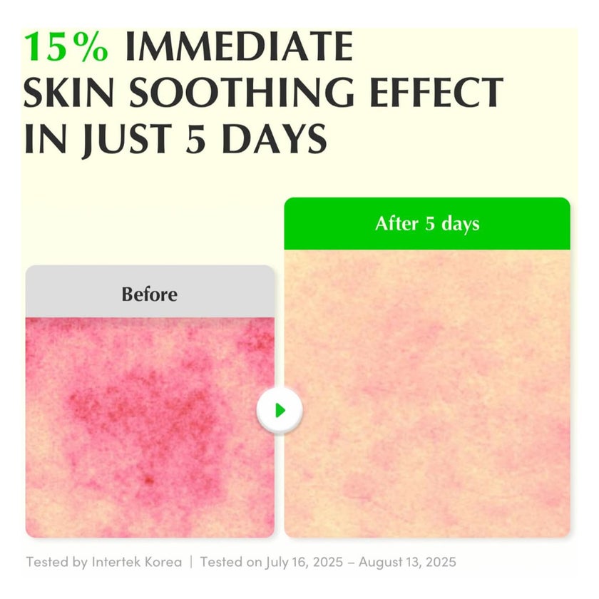 Eqqualberry Green Aid Aloe PDRN Calming Serum 30ml