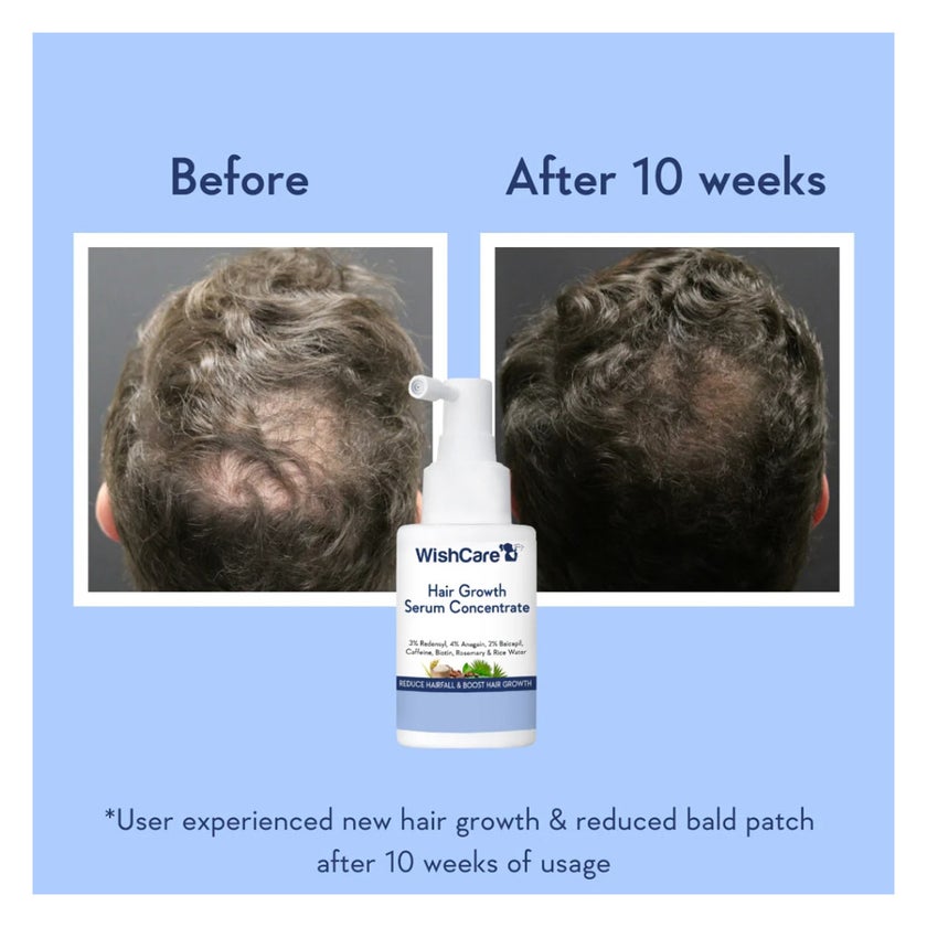 WishCare Hair Growth Serum Concentrate 30ml