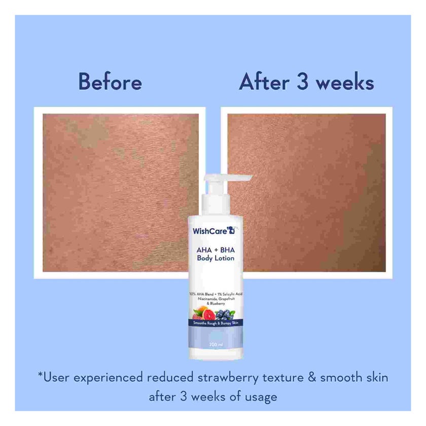 WishCare AHA + BHA Body Lotion 200ml